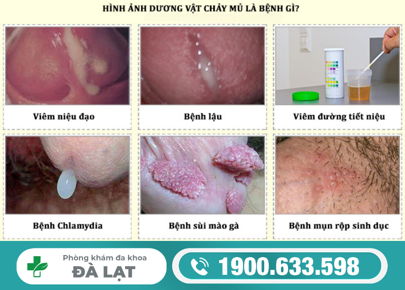 Hình ảnh minh họa